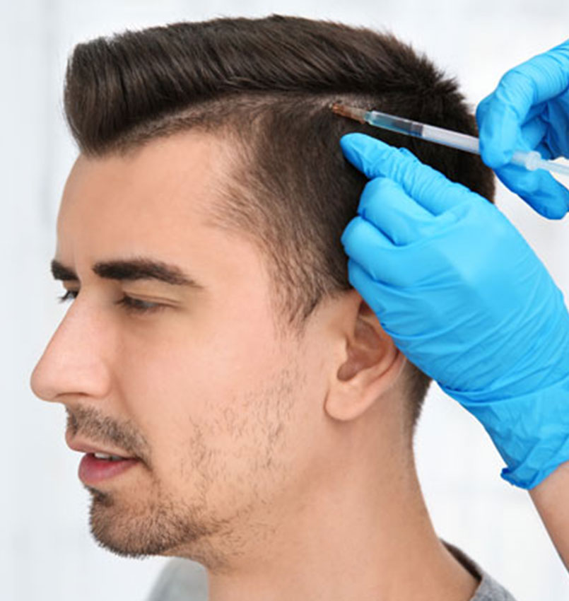 Male Hair Transplant-Newport Beach